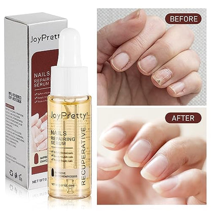 7 días de crecimiento y fortalecimiento de uñas suero 0.7 fl oz solución suavizante de onicomicosis aceite de tratamiento de uñas para uñas descoloridas y dañadas
